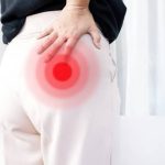 Piriformis Sendromu - siyatik ağrısı